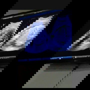 Jadi wory karna BB bayi gedean