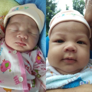 น้องดรีม #เด็กคลอดก่อนกำหนด