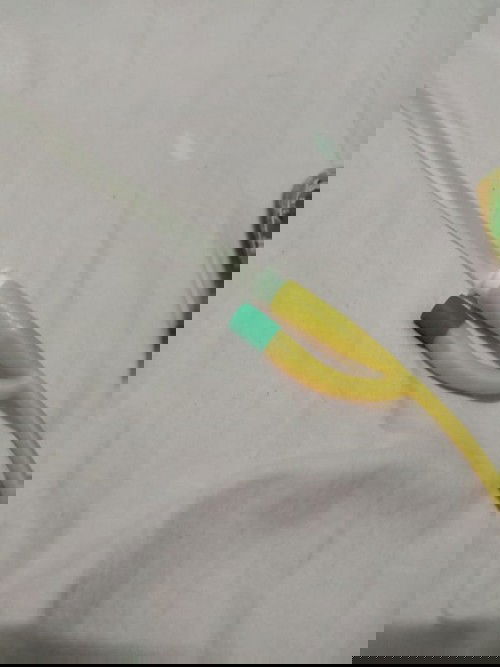 เเม่ๆคนไหนคลอดเองเเล้วฉี่ไม่ออก ต้องใส่สายฉี่กลับบ้านบ้างคะ