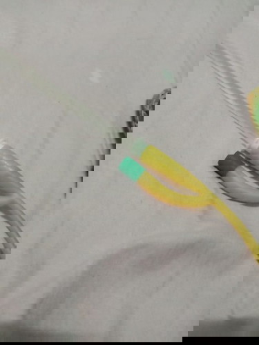 เเม่ๆคนไหนคลอดเองเเล้วฉี่ไม่ออก ต้องใส่สายฉี่กลับบ้านบ้างคะ