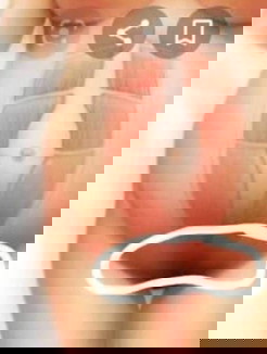 เป้นเฉพาะเวลาไอ