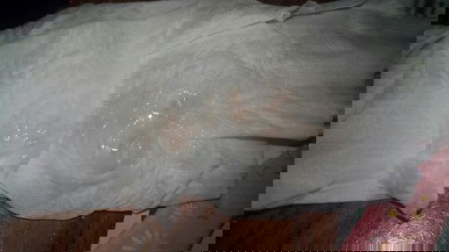 คืออะไร เป็นเมือกๆ มีสีติดเลือดนิดๆ