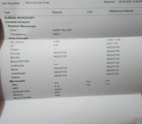 Urinalysis