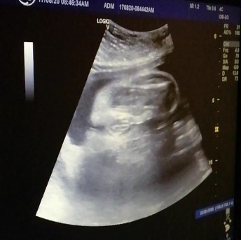 Scan Baby