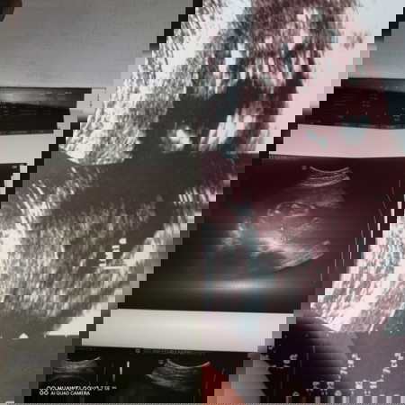 Ask Lang Po Na Stress Na Po Kse AKo Kakaisip