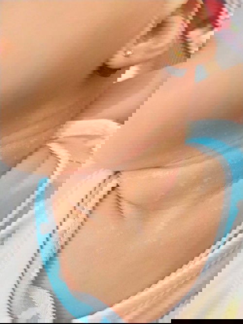 Bintik putih dileher bayi umur 2bulan