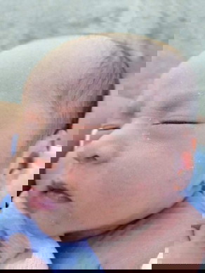 Rashes ng baby ano gamot?