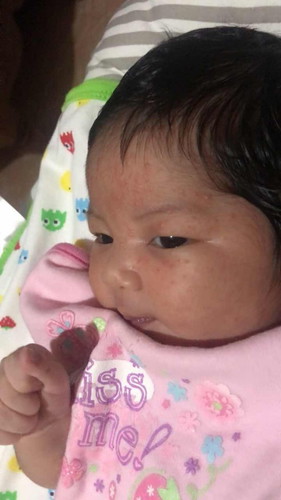 New born Rashes π help!