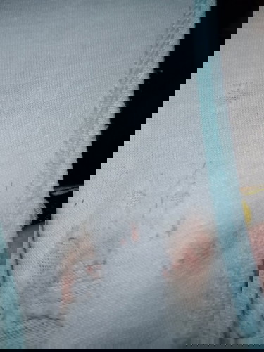 Spotting at 35 weeks