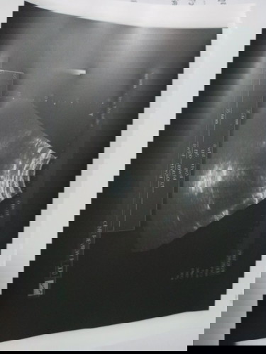 8วิค +1ค่ะ แต่ยังไม่เจอน้อง