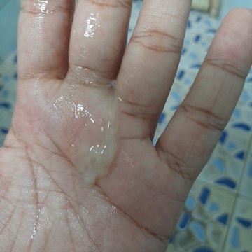 มูกหรือตกขาว ??