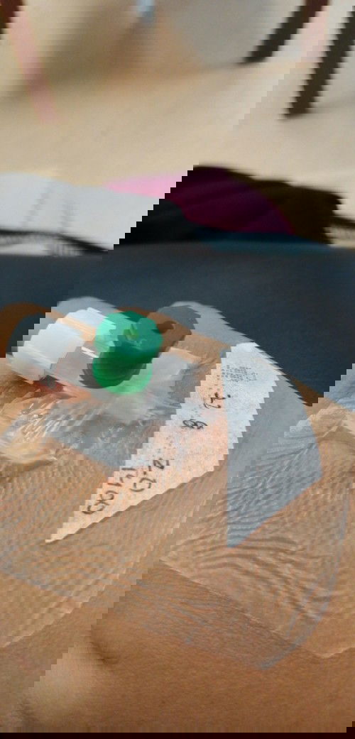 Bukaan 1cm! 37week 2 Day