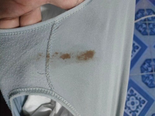 39 w ไปเข้าห้องน้ำปัสสวะแล้วมีแบบนี้ออกมาคืออะไรหรอค่ะ