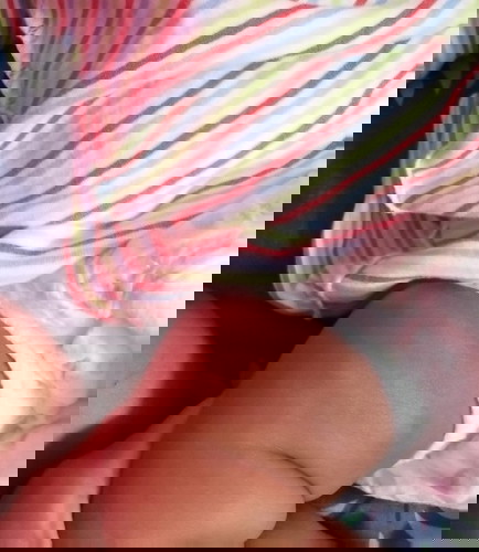 ลูกเป็นดวงขาวๆที่น่องขาด้านหน้า