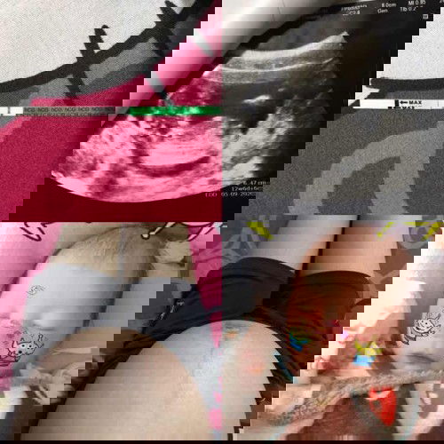 คลอดธรรมชาติ