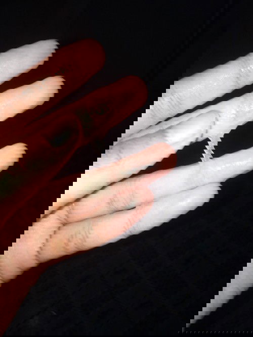 บ้านห่างจาก รพ ค่ะจะไปแต่ล่ะครั้งต้องเป้นอะไรจิงๆ❤️