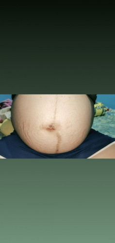 ทายเพศลูก
