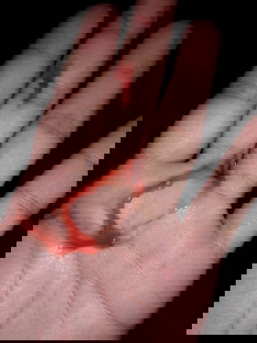 คงอีกไม่นานหน้าจะคลอด