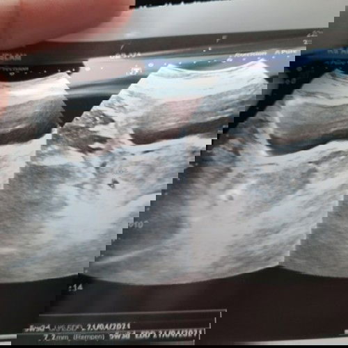 Trauma BO kedua kali