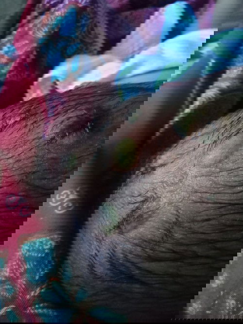 kepala bayi kaya bisul