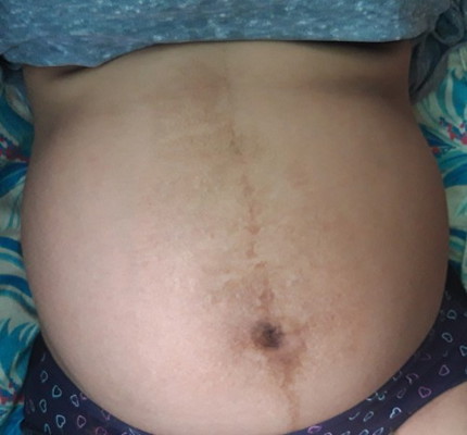 34weeks@1day EDD October 3, 2020