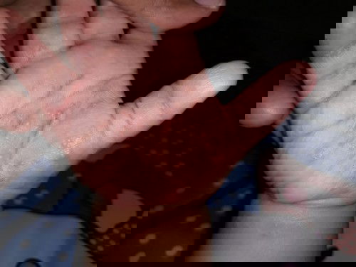 Timbul bintik2 merah klw dh gatell