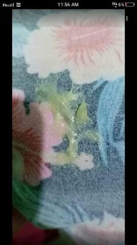 it its a mucus plug