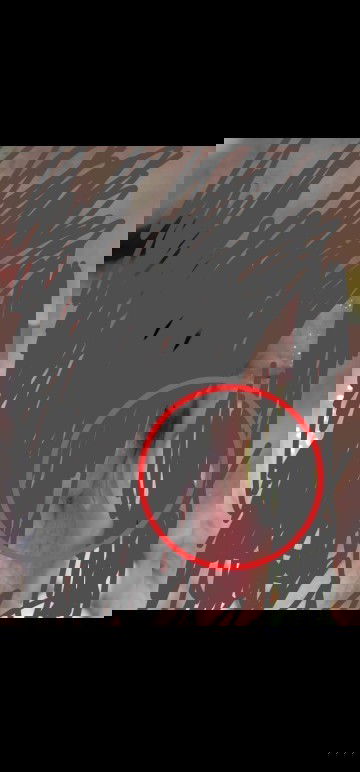 obat sariawan yang aman untuk bumil