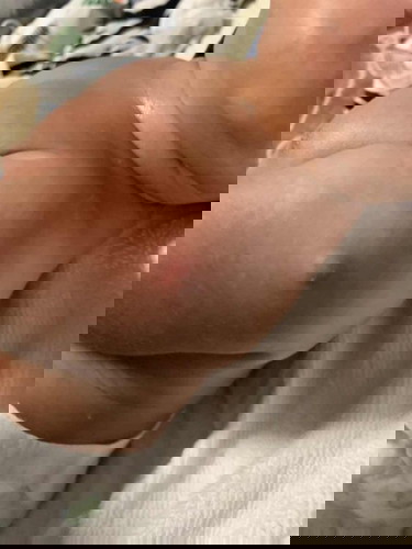 A small bump