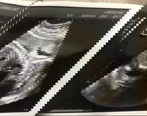 รอวันนั้นนะลูก ขอไห้หนูเเข็งเเรงน่ะ
พ่อกับเเม่ รอหนูยุน่าา❤️❤️❤️