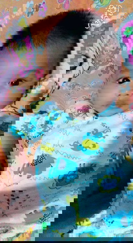 เราผ่าคลอด