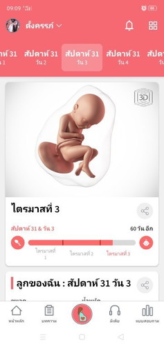 ปวดหัวหน่าว 31+3