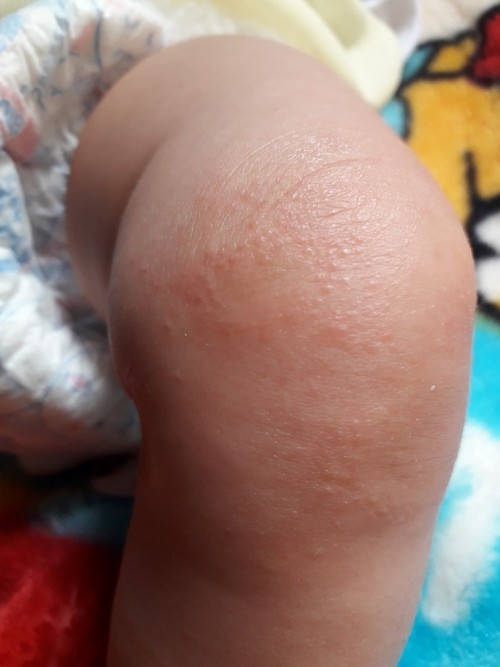 seputar bayi