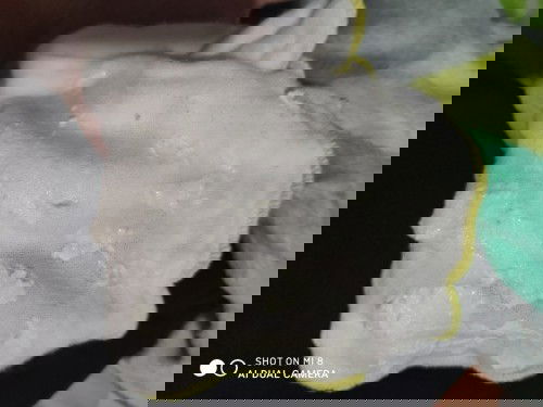 Nôn trớ của bé