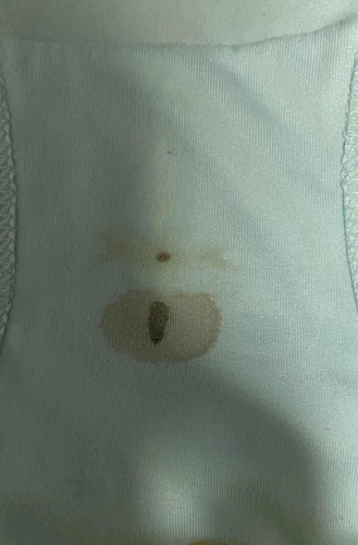 แบบนี้ใช่เลือดล้างหน้าเด็กไหมคะ