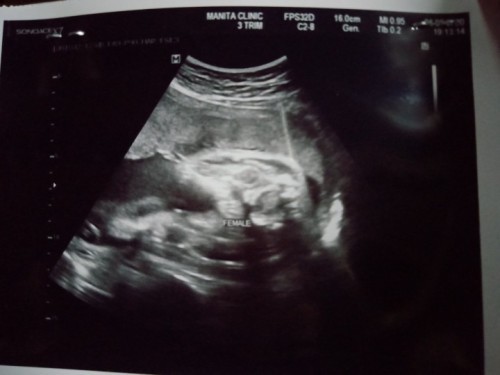 น้ำหนักลูก