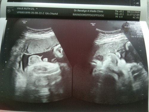 sonogram