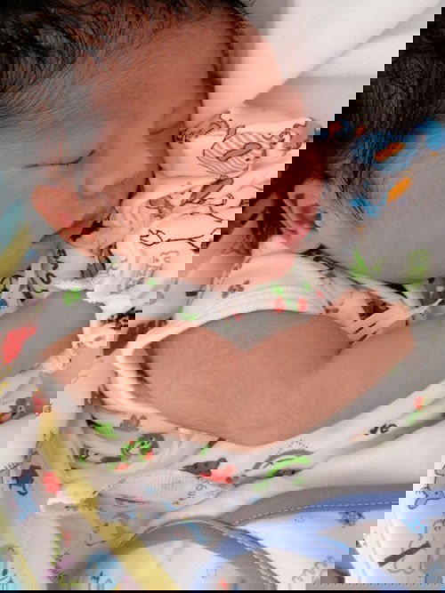 หลังคลอด​ ผ่าตัดคลอด