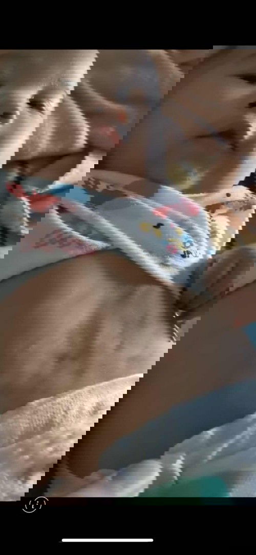 น้องท้องเป็นคลื่นเวลาเกร็งท้อง