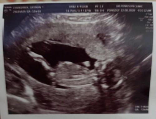 เจ้าจิ๋วของแม่💓💓