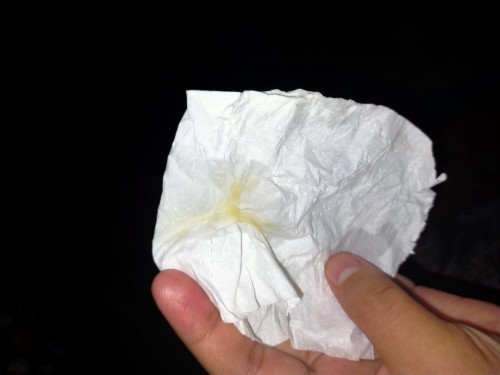 Discharge ( parang sipon )