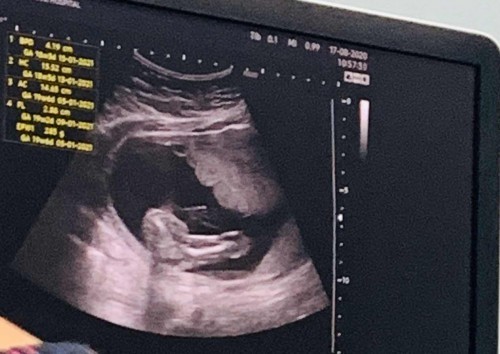 ผลตรวจ 19W