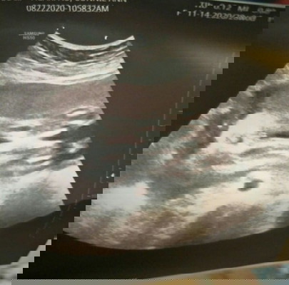 Baby's Gender