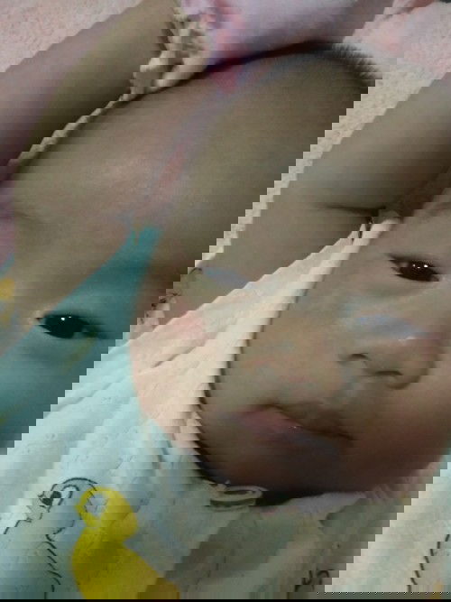 ผิวหน้าแห้งเป็นรอยเเดง