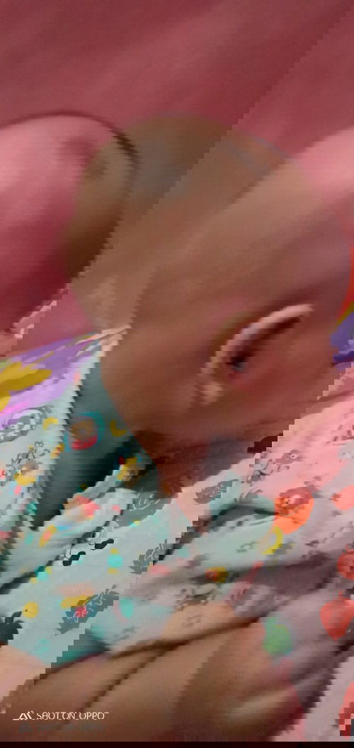 Apakh kpl baby saya datar