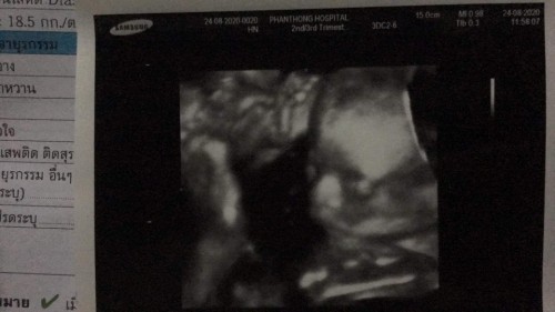 19+5 ได้เพศชายค่ะ