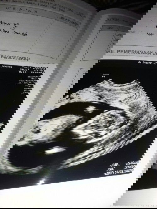 Mau tanya keterangan nya apa nya😊🙏