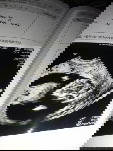 Mau tanya keterangan nya apa nya😊🙏