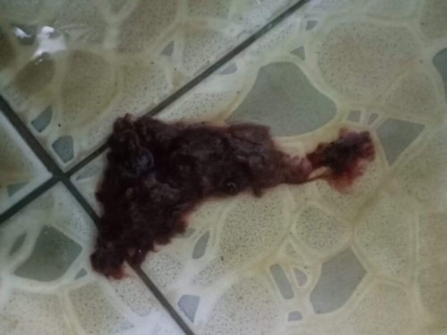 หลังคลอด2อาทิตย์กว่า