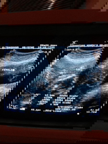 Curious (ultrasound)